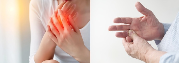 손가락 통증을 부르는 5가지 질환1